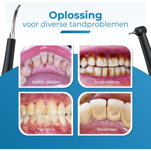 Professionele Tandsteen Verwijderaar – 5 standen – Inclusief Tandarts Set – 3 opzetstukken
